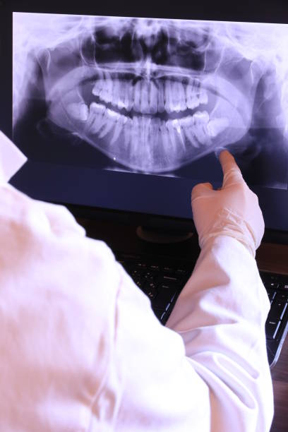 Best Emergency Dentist for Knocked-Out Tooth in Citrus Hills, FL