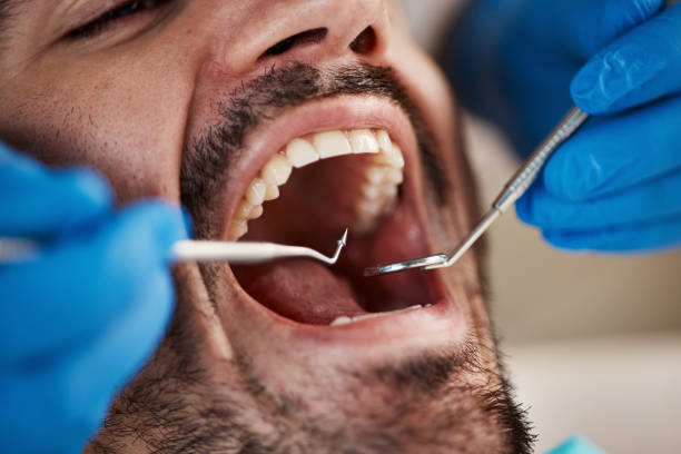 Best Orthodontic Emergency Dentist in Citrus Hills, FL