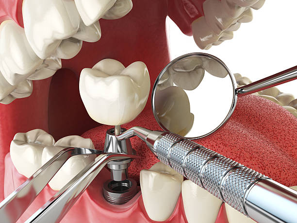 Emergency Cosmetic Dentistry